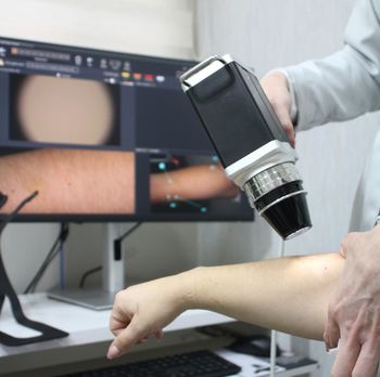 Regular dermatoscopia1